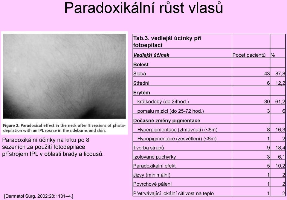 oblasti brady a licousů. [Dermatol Surg. 2002;28:1131 4.] Bolest Slabá 43 87,8 Střední 6 12,2 Erytém krátkodobý (do 24hod.