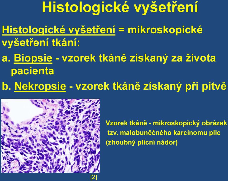 Biopsie - vzorek tkáně získaný za života pacienta b.