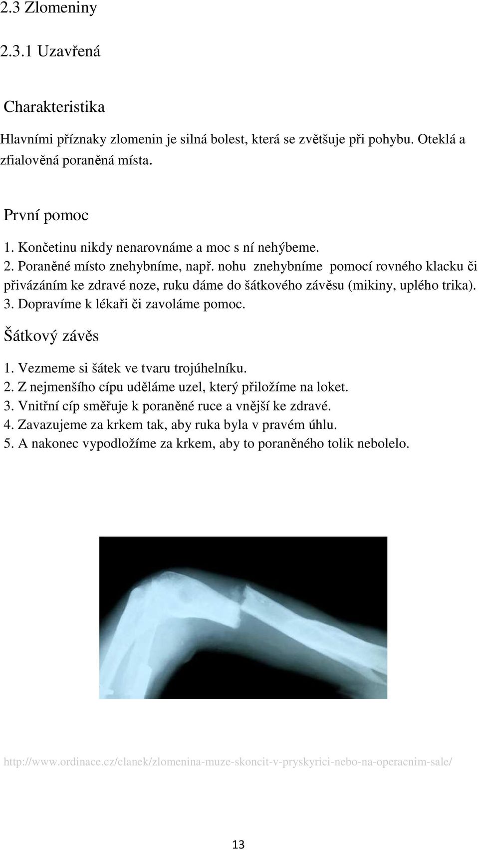 nohu znehybníme pomocí rovného klacku či přivázáním ke zdravé noze, ruku dáme do šátkového závěsu (mikiny, uplého trika). 3. Dopravíme k lékaři či zavoláme pomoc. Šátkový závěs 1.