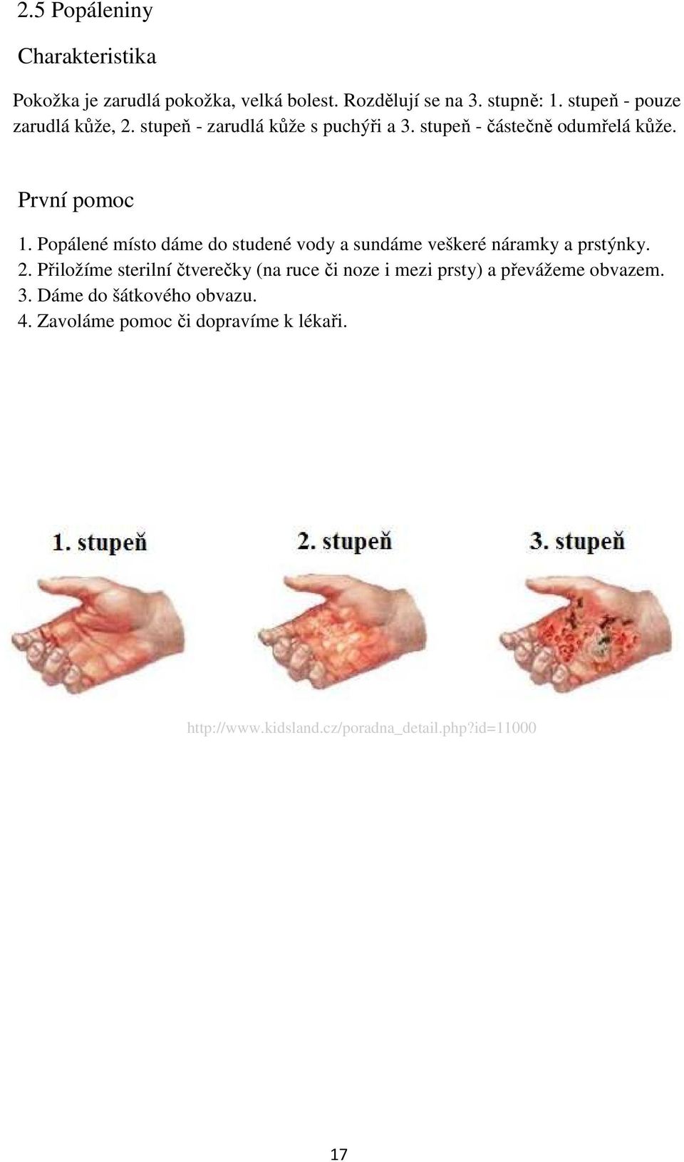 Popálené místo dáme do studené vody a sundáme veškeré náramky a prstýnky. 2.