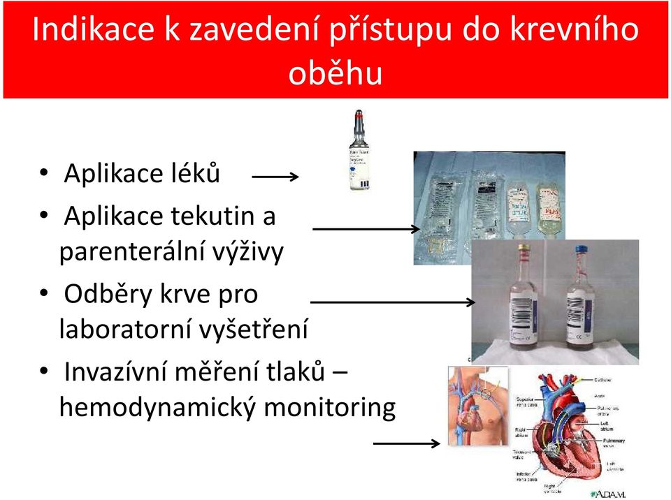 výživy Odběry krve pro laboratorní vyšetření