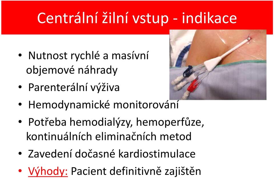 Potřeba hemodialýzy, hemoperfůze, kontinuálních eliminačních