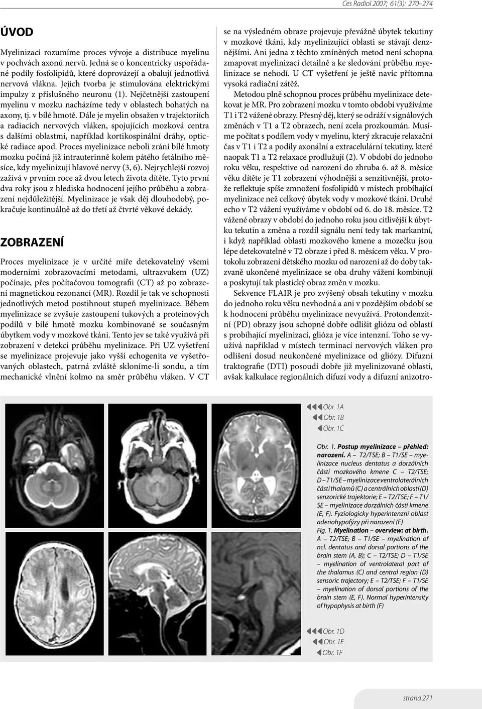 Dále je myelin obsažen v trajektoriích a radiacích nervových vláken, spojujících mozková centra s dalšími oblastmi, například kortikospinální dráhy, optické radiace apod.