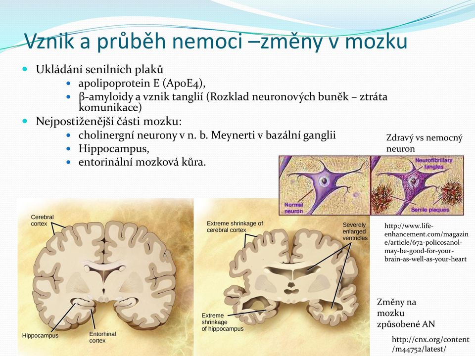 Zdravý vs nemocný neuron http://www.lifeenhancement.