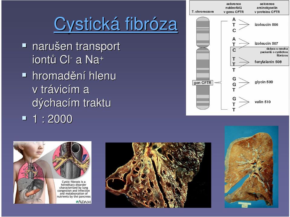 hromadění hlenu v trávic