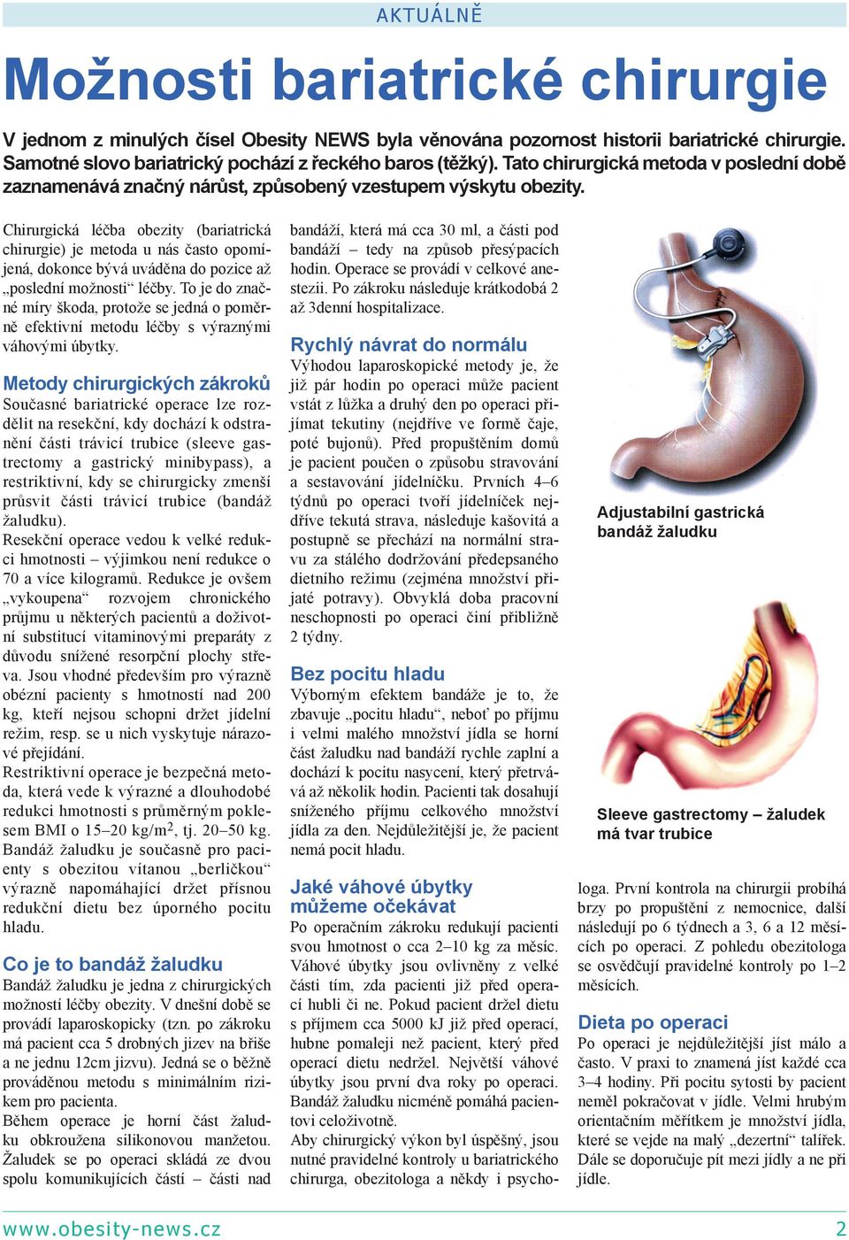 Chirurgická léčba obezity (bariatrická chirurgie) je metoda u nás často opomíjená, dokonce bývá uváděna do pozice až poslední možnosti léčby.