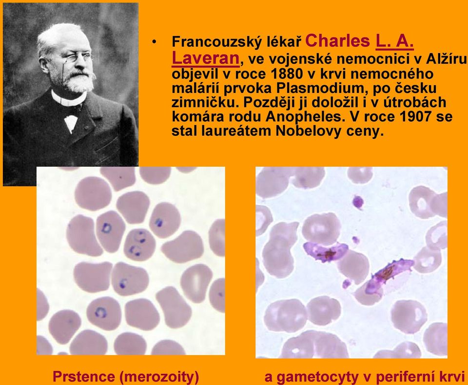 malárií prvoka Plasmodium, po česku zimničku.