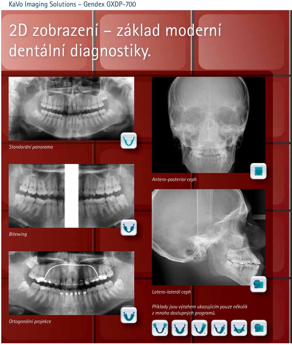 Latero-laterál ceph Ortogonální projekce Příklady jsou