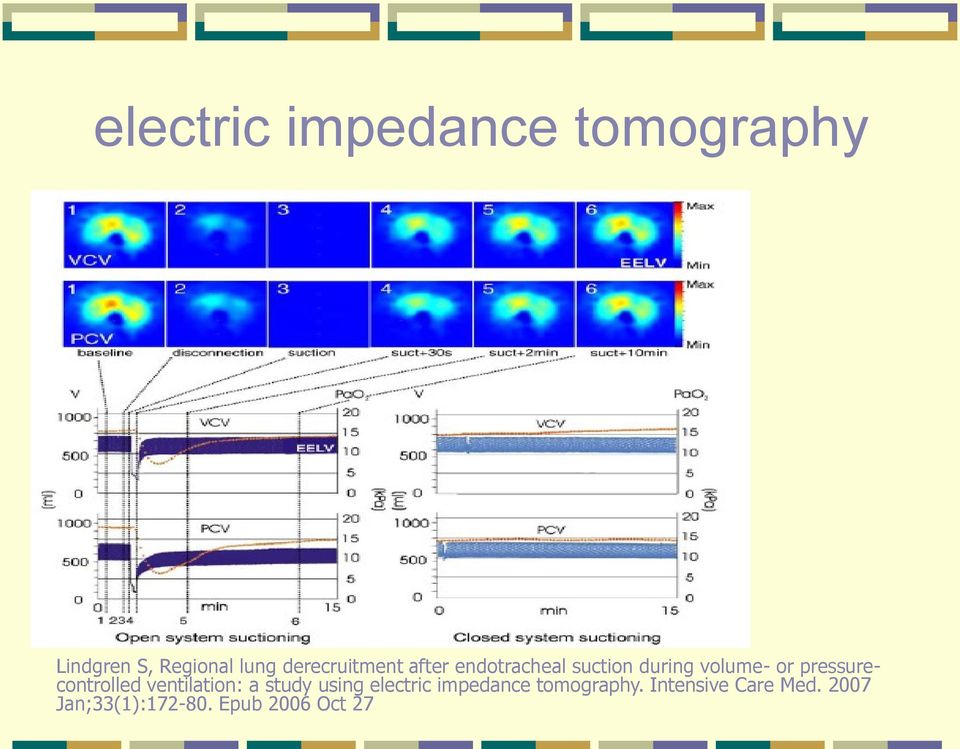 pressurecontrolled ventilation: a study using electric