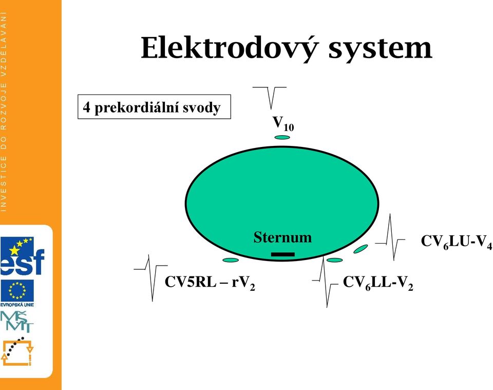 10 Sternum CV 6 LU-V