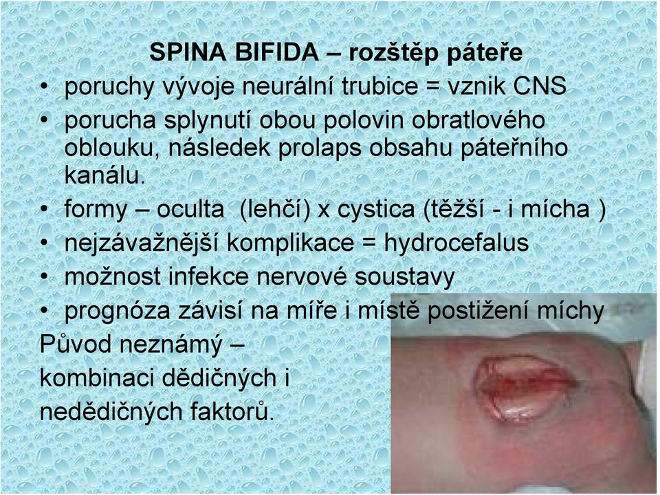 formy oculta (lehčí) x cystica (těžší - i mícha ) nejzávažnější komplikace = hydrocefalus možnost