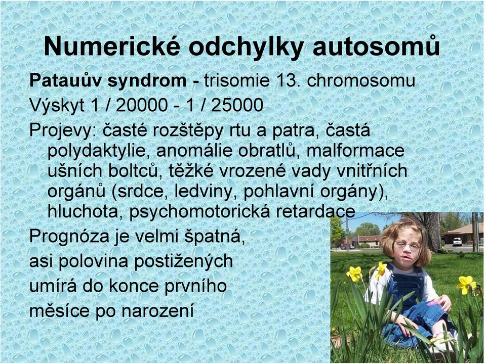 anomálie obratlů, malformace ušních boltců, těžké vrozené vady vnitřních orgánů (srdce, ledviny,