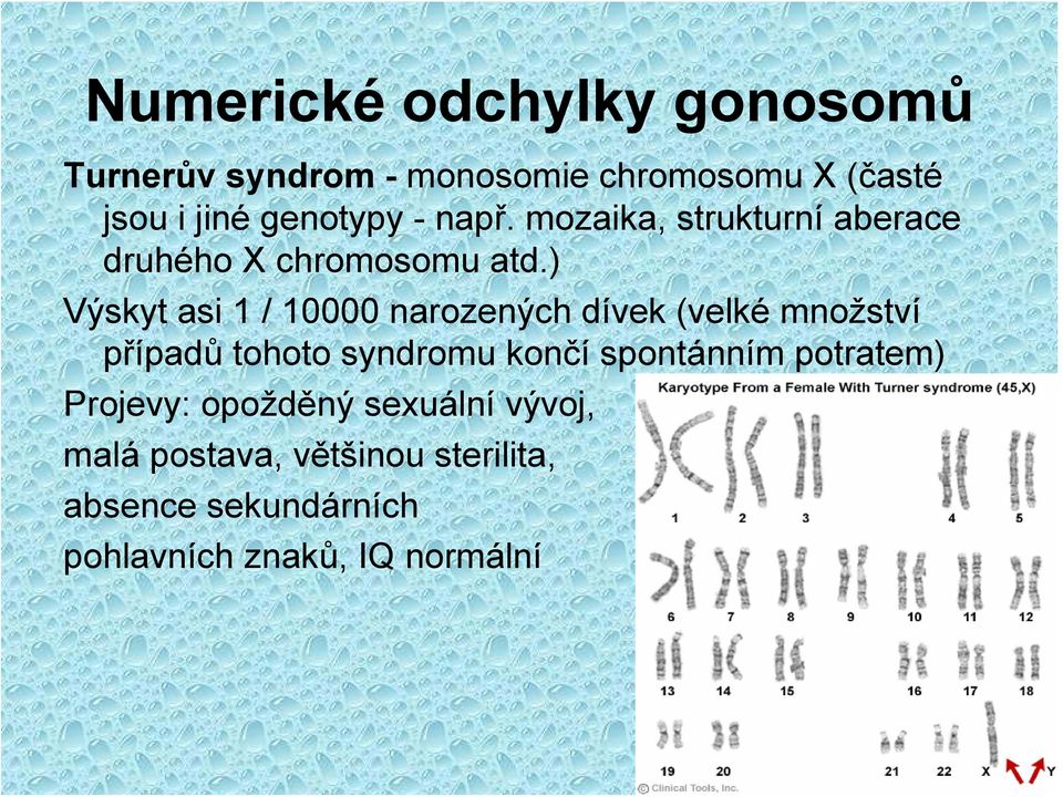 ) Výskyt asi 1 / 10000 narozených dívek (velké množství případů tohoto syndromu končí