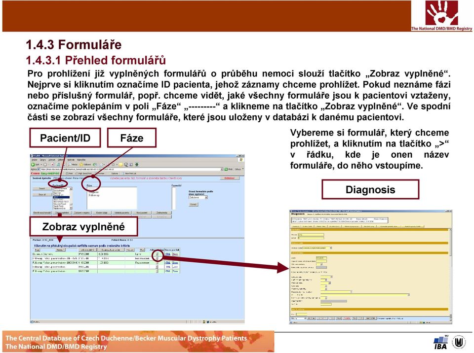 chceme vidět, jaké všechny formuláře jsou k pacientovi vztaženy, označíme poklepáním v poli Fáze --------- a klikneme na tlačítko Zobraz vyplněné.