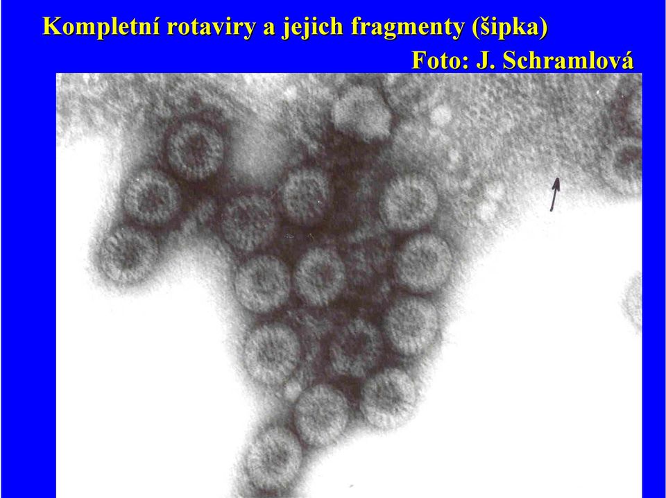 jejich fragmenty