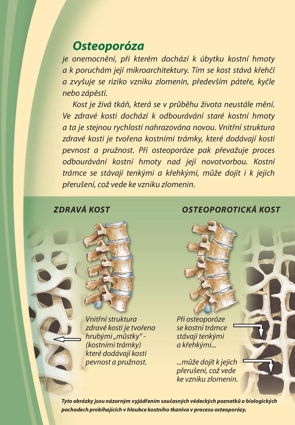 Ve zdravé kosti dochází k odbourávání staré kostní hmoty a ta je stejnou rychlostí nahrazována novou.