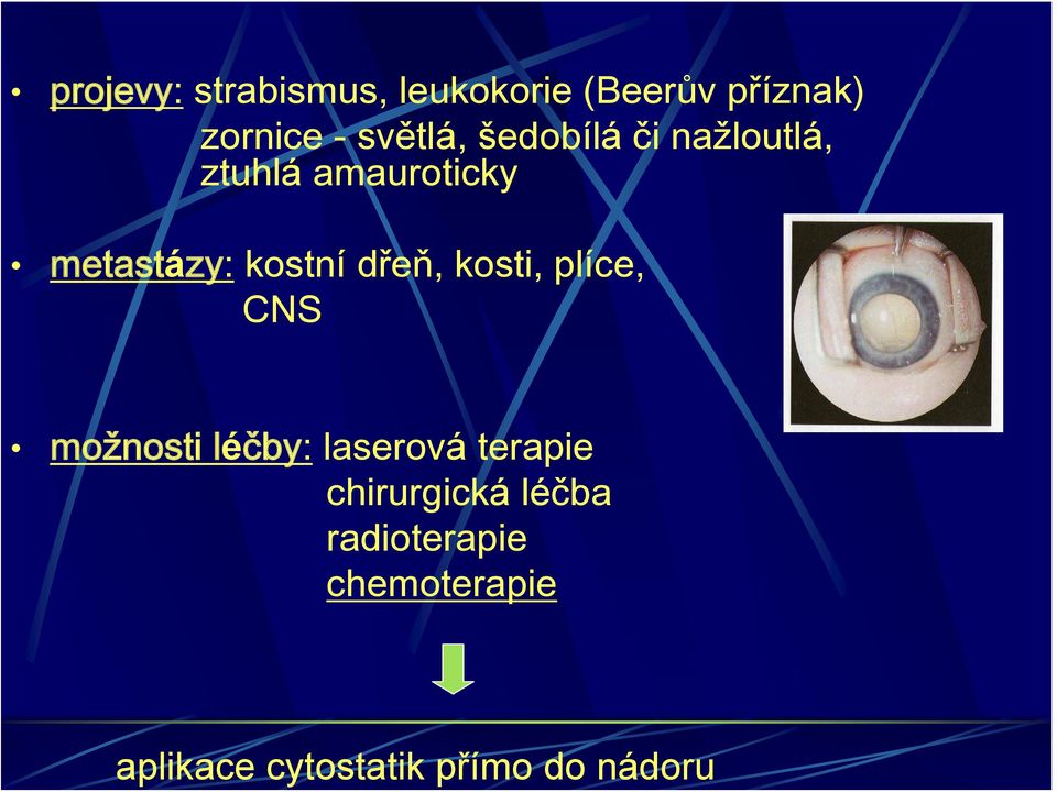 nažloutlá, ztuhlá amauroticky metastázy: kostní dřeň, kosti,