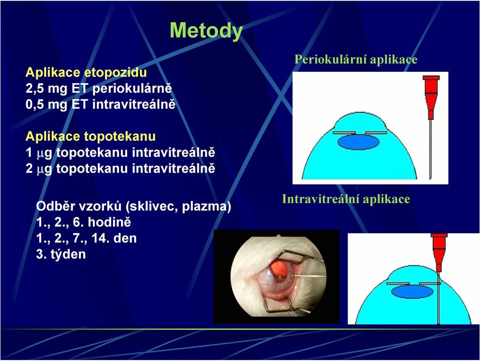 intravitreálně 2 μg topotekanu intravitreálně Odběr vzorků (sklivec,