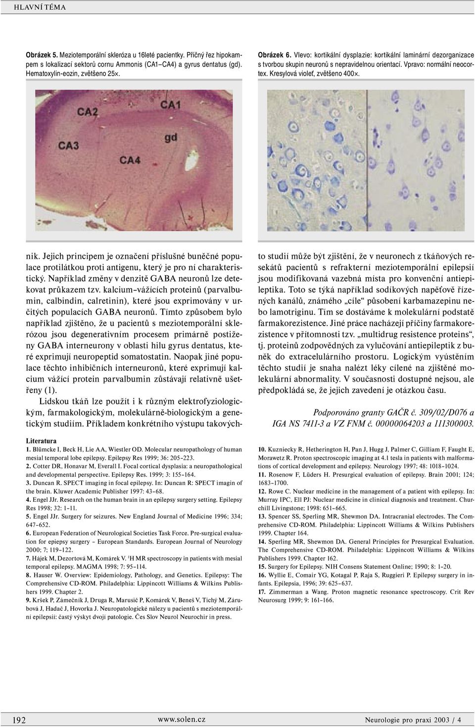 Blümcke I, Beck H, Lie AA, Wiestler OD. Molecular neuropathology of human mesial temporal lobe epilepsy. Epilepsy Res 1999; 36: 205 223. 2. Cotter DR, Honavar M, Everall I.