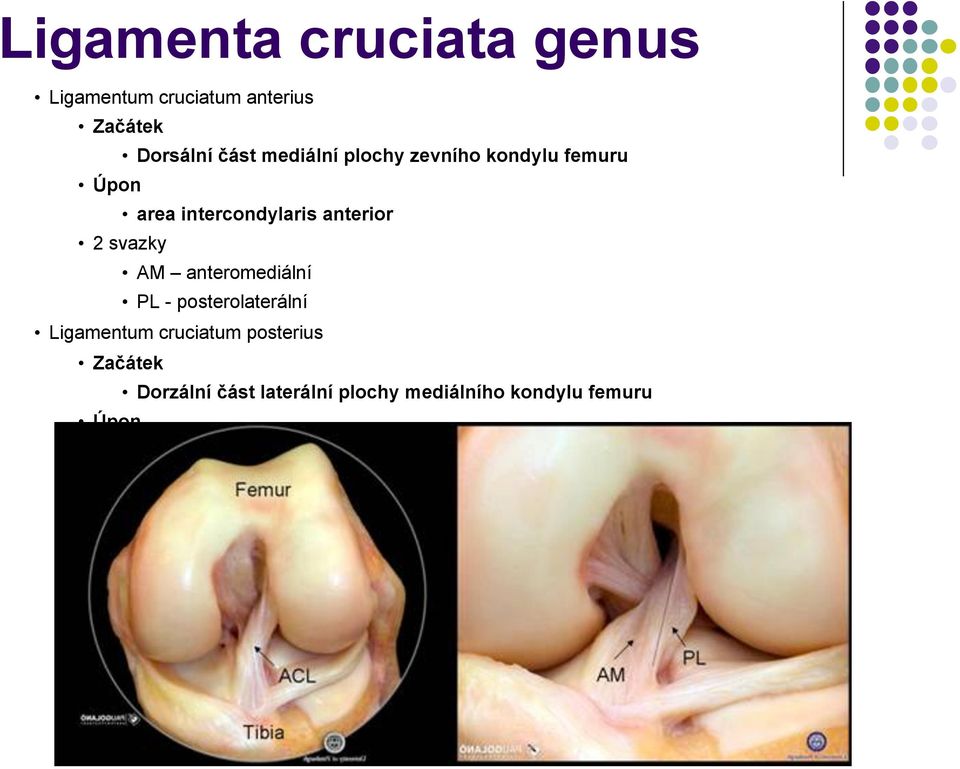 kondylu femuru Úpon area intercondylaris anterior 2 svazky AM anteromediální PL -