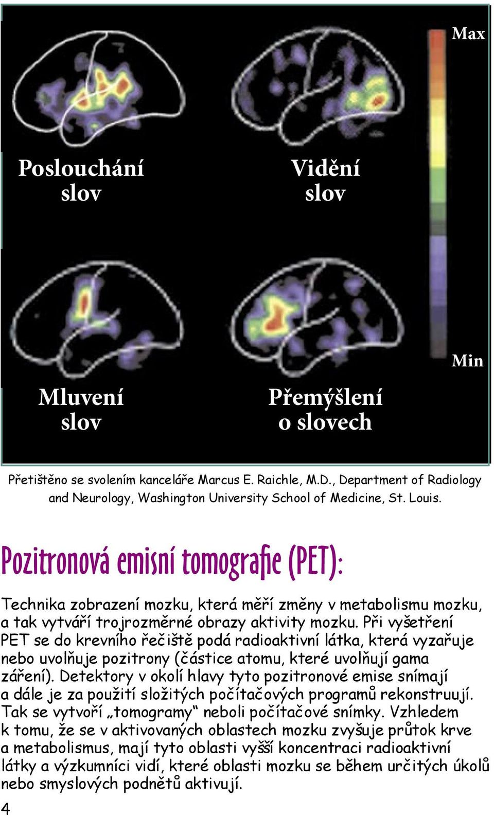 Pozitronová emisní tomografie (PET): Technika zobrazení mozku, která měří změny v metabolismu mozku, a tak vytváří trojrozměrné obrazy aktivity mozku.