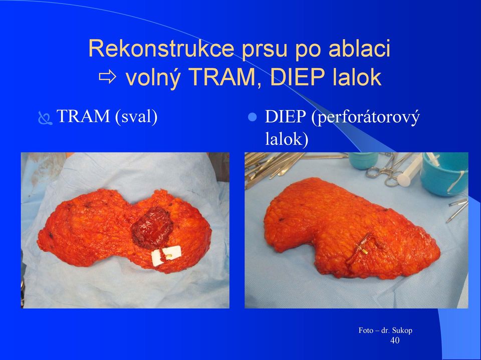 lalok TRAM (sval) DIEP