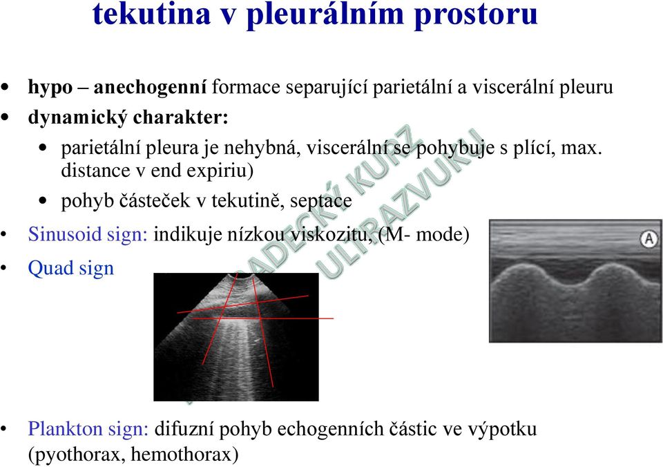 distance v end expiriu) pohyb částeček v tekutině, septace Sinusoid sign: indikuje nízkou