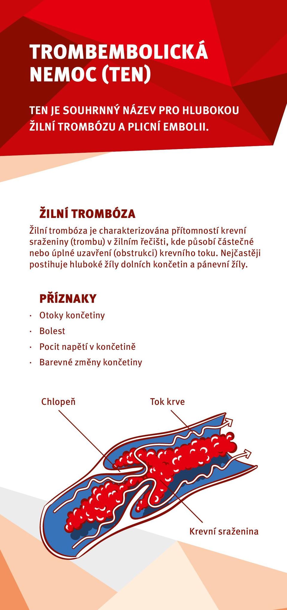 řečišti, kde působí částečné nebo úplné uzavření (obstrukci) krevního toku.