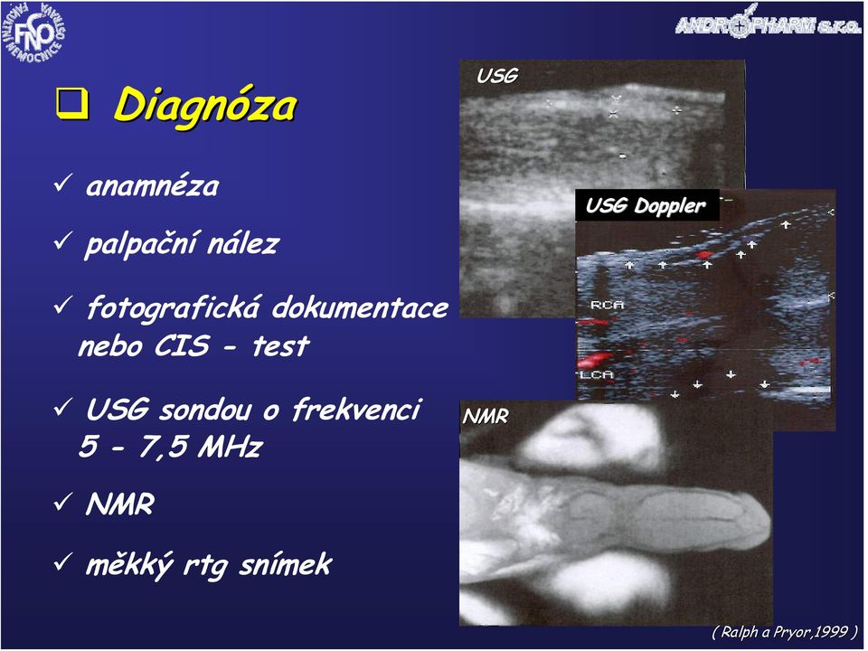 - test USG sondou o frekvenci 5-7,5 MHz