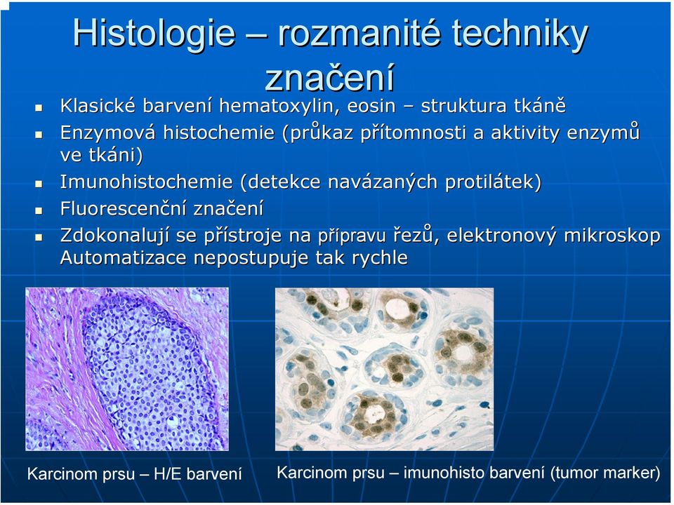 protilátek) tek) Fluorescenční značen ení Zdokonalují se přístroje p na přípravupravu řezů,, elektronový