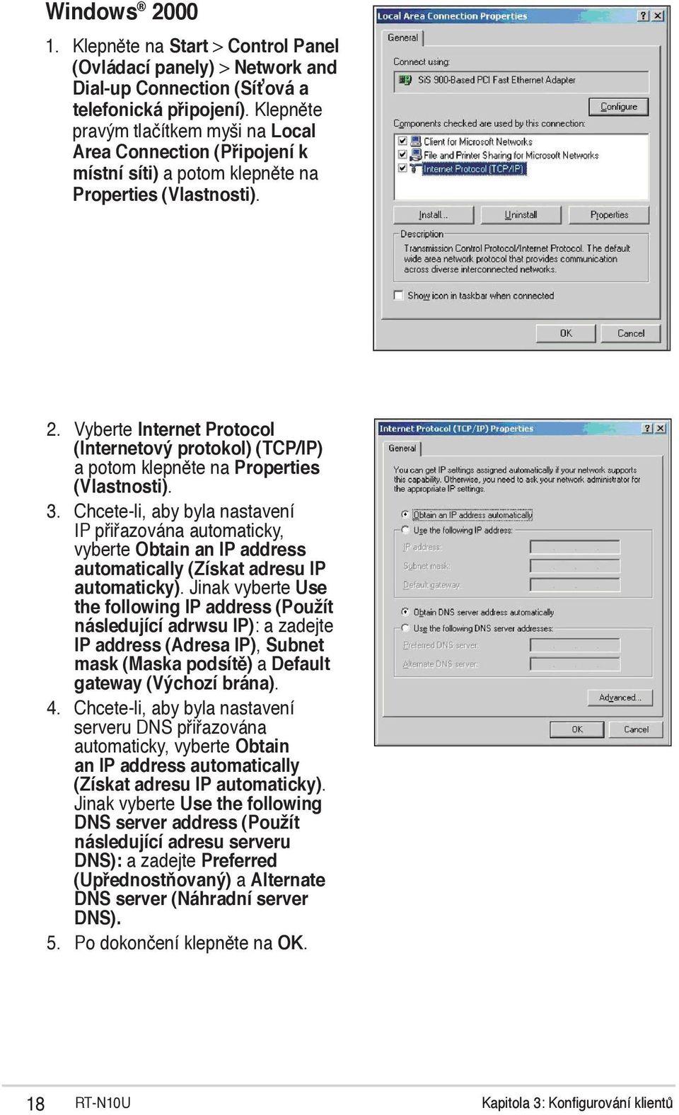 Vyberte Internet Protocol (Internetový protokol) (TCP/IP) a potom klepněte na Properties (Vlastnosti). 3.