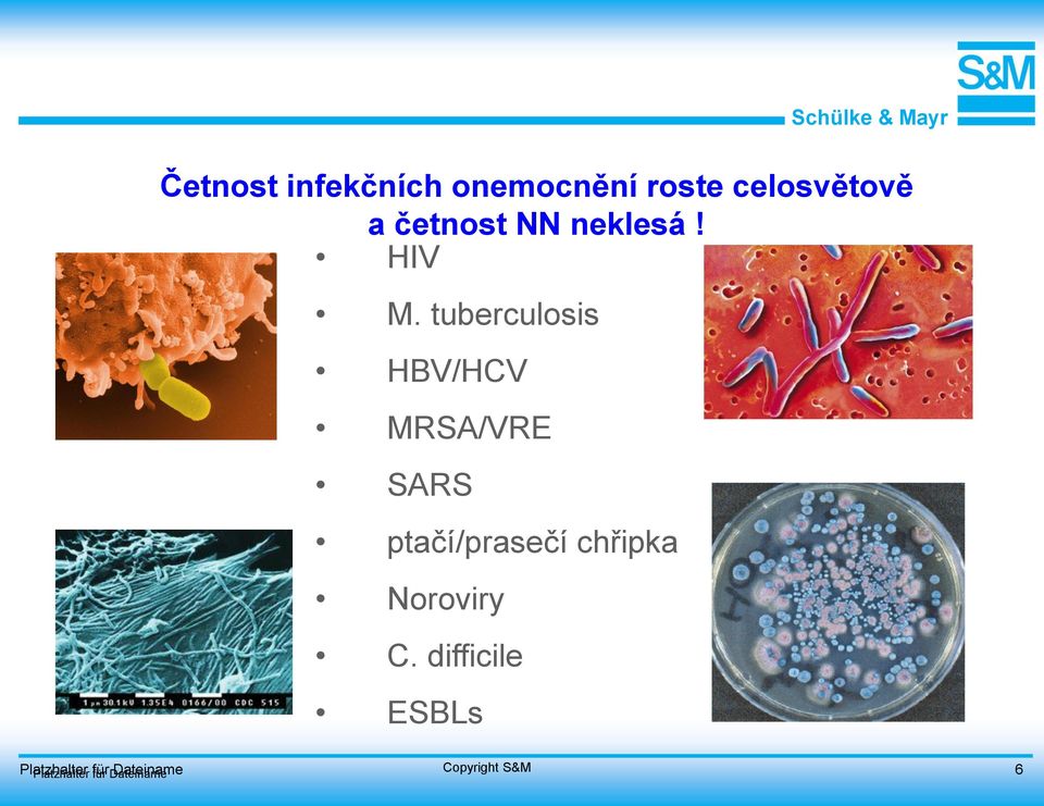 tuberculosis HBV/HCV MRSA/VRE SARS