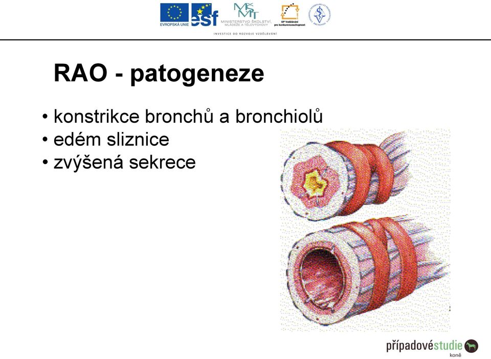 a bronchiolů edém