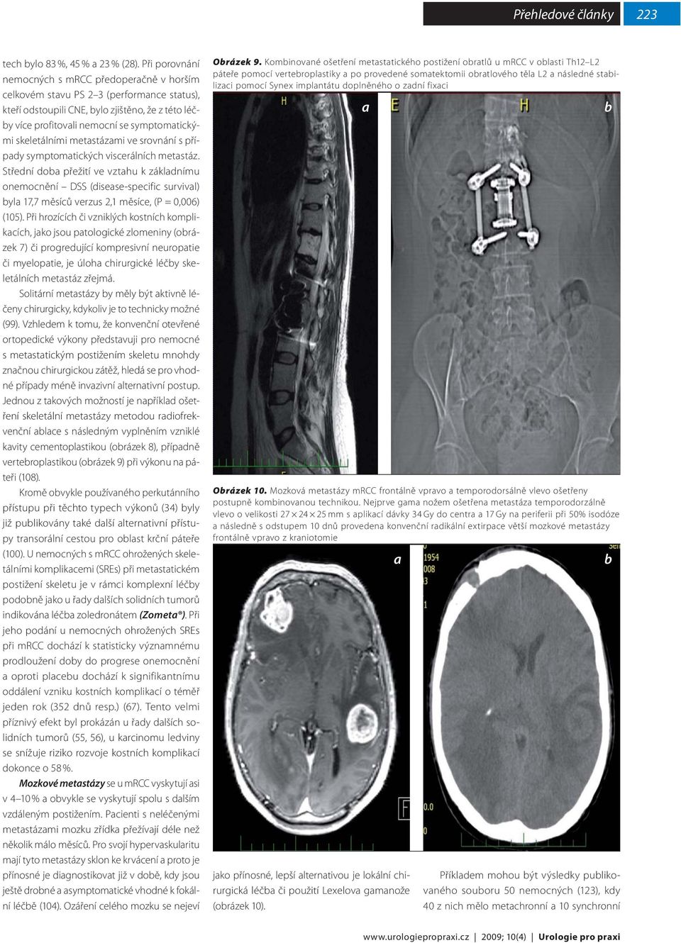 skeletálními metastázami ve srovnání s případy symptomatických viscerálních metastáz.