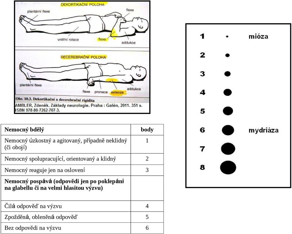 3 Nemocný pospává (odpovědi jen po poklepání na glabellu či na velmi hlasitou