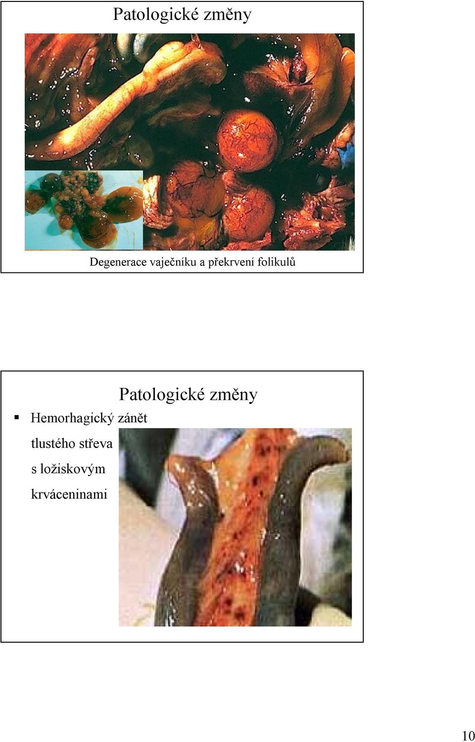 Hemorhagický zánět tlustého střeva