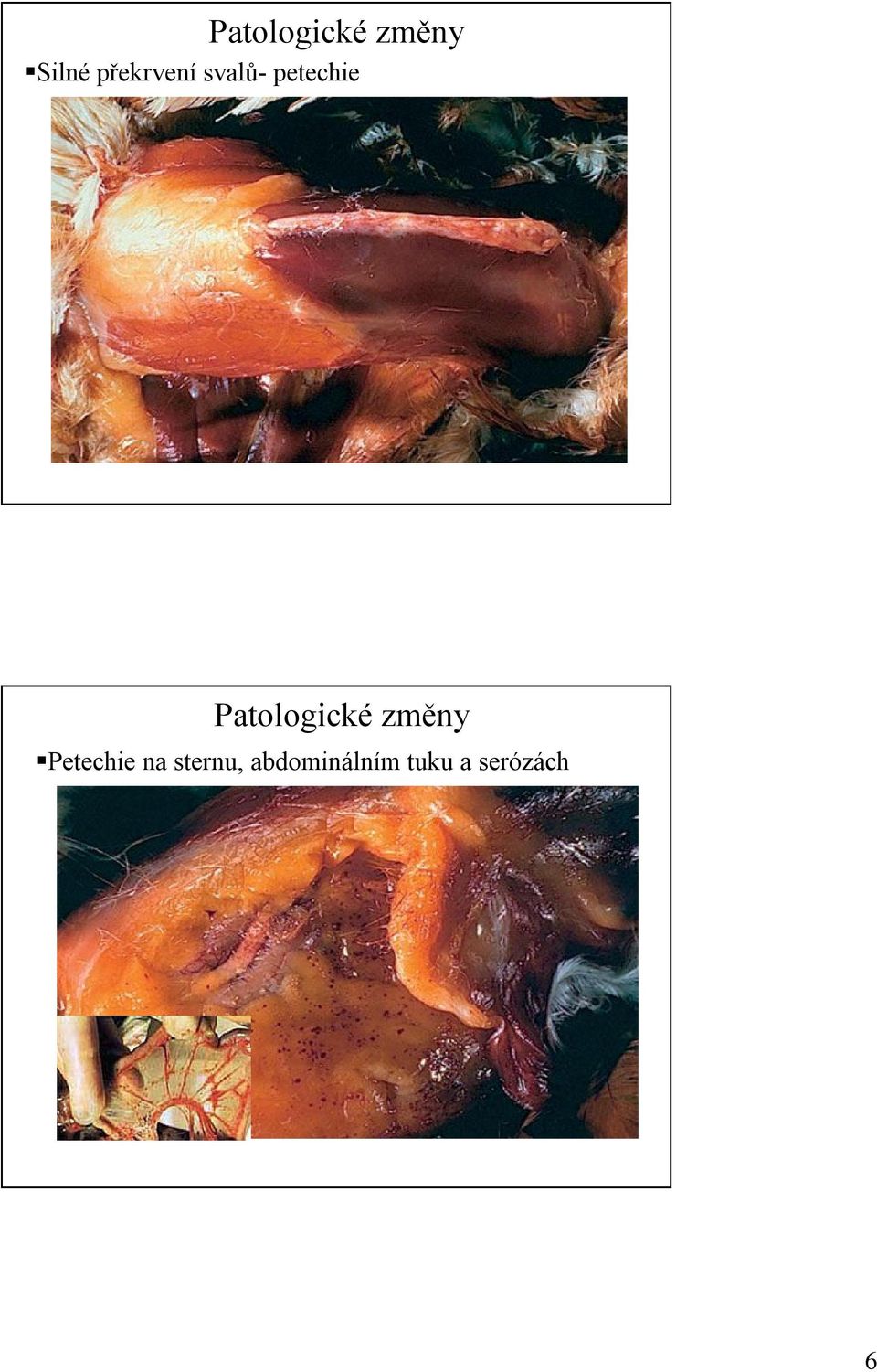 Patologické změny Petechie na