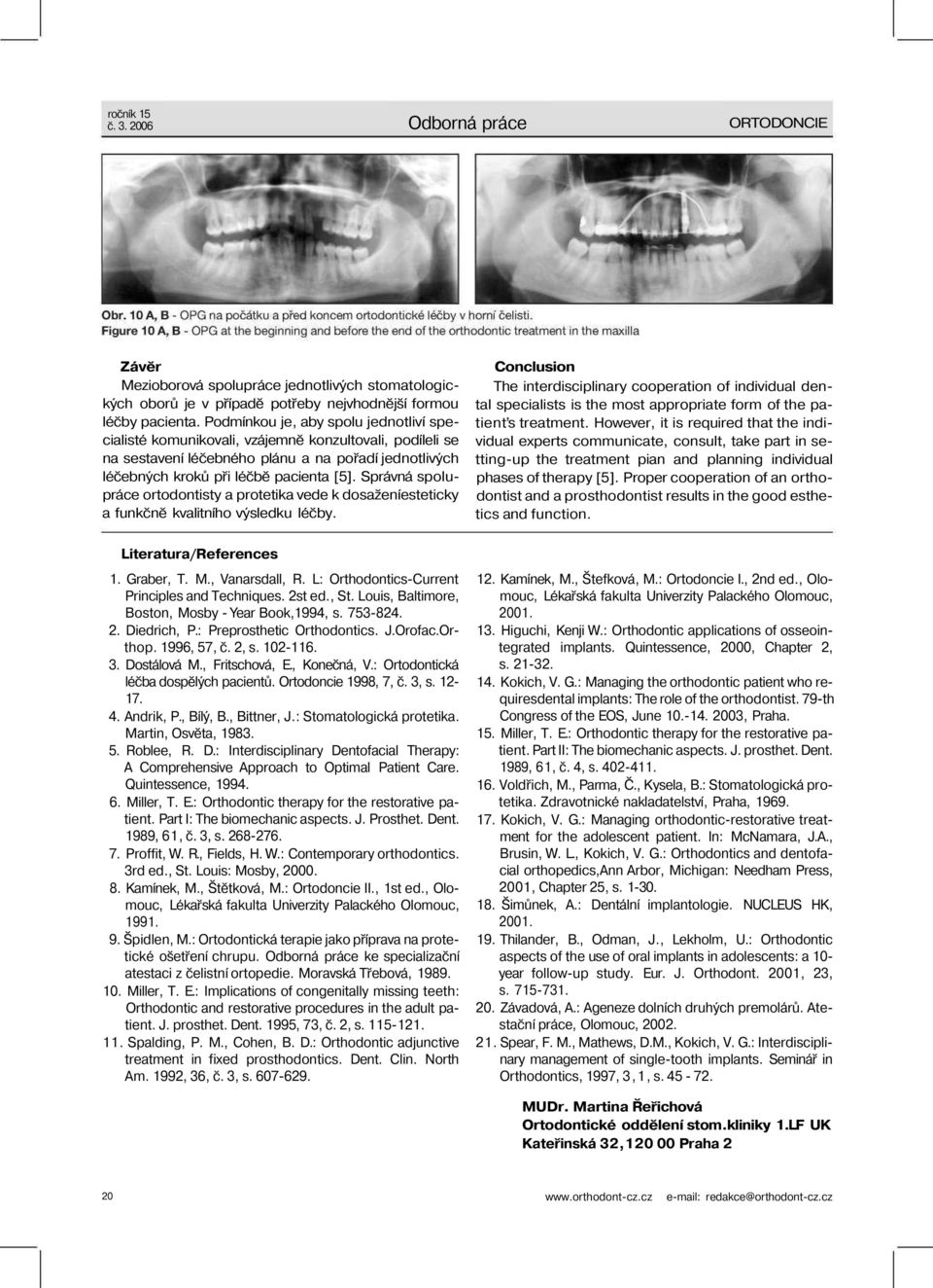 Správná spolupráce ortodontisty a protetika vede k dosaženíesteticky a funkčně kvalitního výsledku léčby. Literatura/References 1. Graber, T. M., Vanarsdall, R.