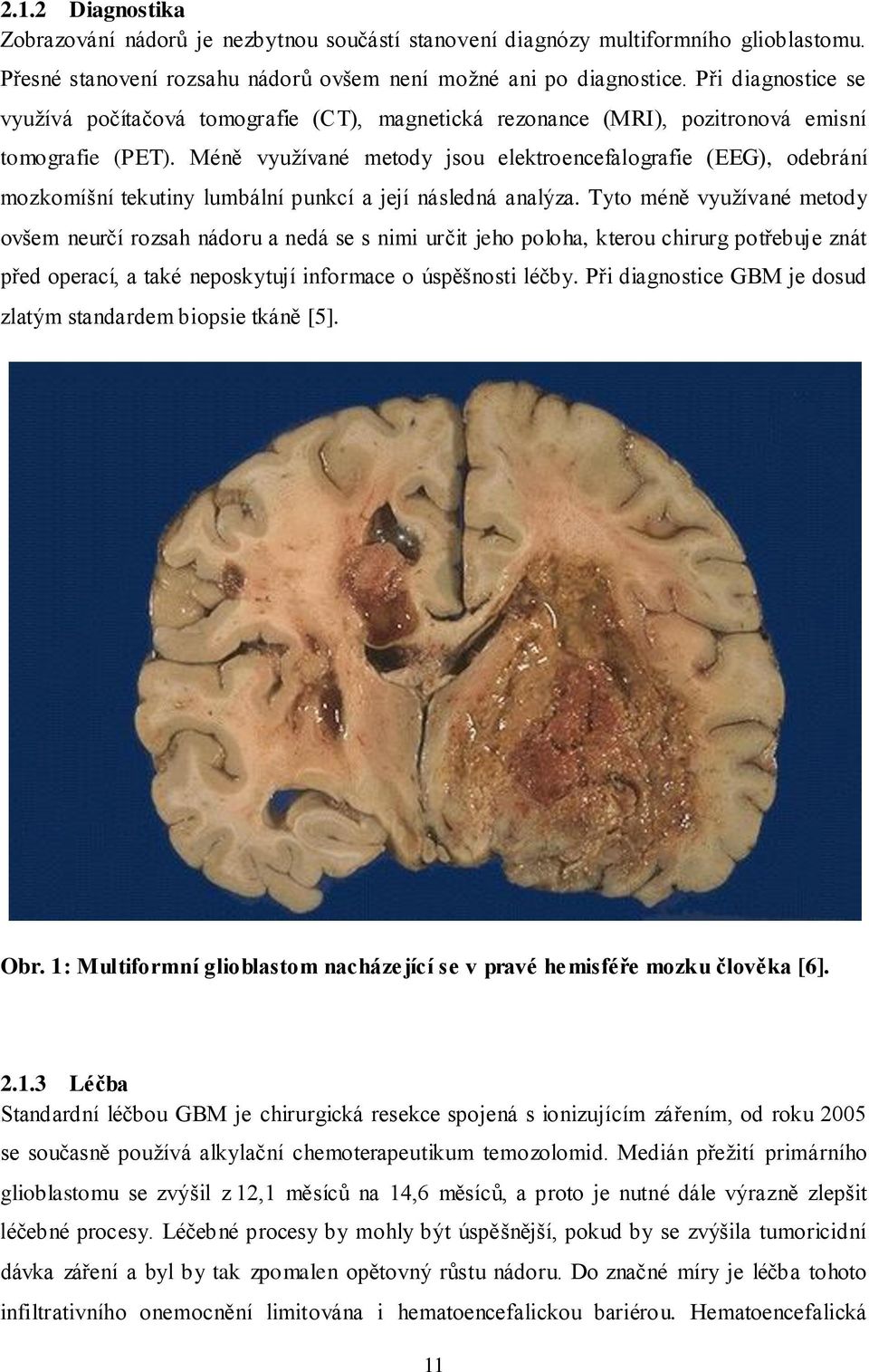 Méně využívané metody jsou elektroencefalografie (EEG), odebrání mozkomíšní tekutiny lumbální punkcí a její následná analýza.