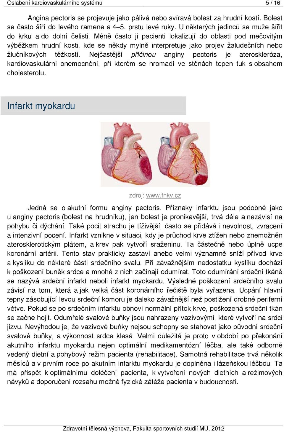 Méně často ji pacienti lokalizují do oblasti pod mečovitým výběžkem hrudní kosti, kde se někdy mylně interpretuje jako projev žaludečních nebo žlučníkových těžkostí.