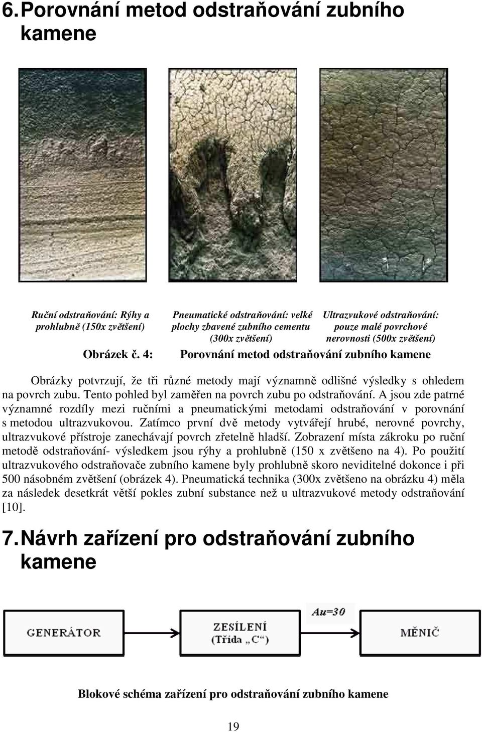 kamene Obrázky potvrzují, že tři různé metody mají významně odlišné výsledky s ohledem na povrch zubu. Tento pohled byl zaměřen na povrch zubu po odstraňování.