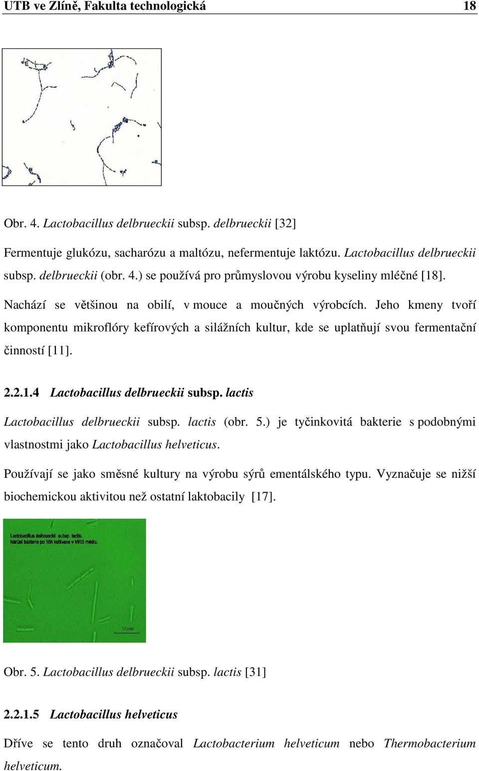 Jeho kmeny tvoří komponentu mikroflóry kefírových a silážních kultur, kde se uplatňují svou fermentační činností [11]. 2.2.1.4 Lactobacillus delbrueckii subsp. lactis Lactobacillus delbrueckii subsp.