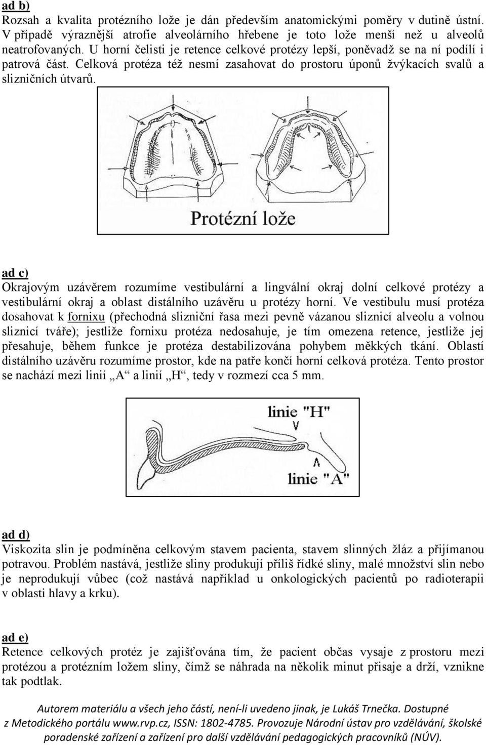 ad c) Okrajovým uzávěrem rozumíme vestibulární a lingvální okraj dolní celkové protézy a vestibulární okraj a oblast distálního uzávěru u protézy horní.