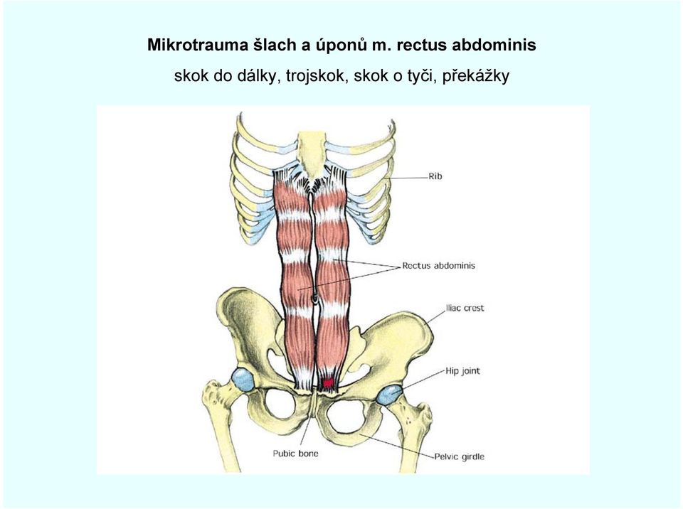 rectus abdominis skok