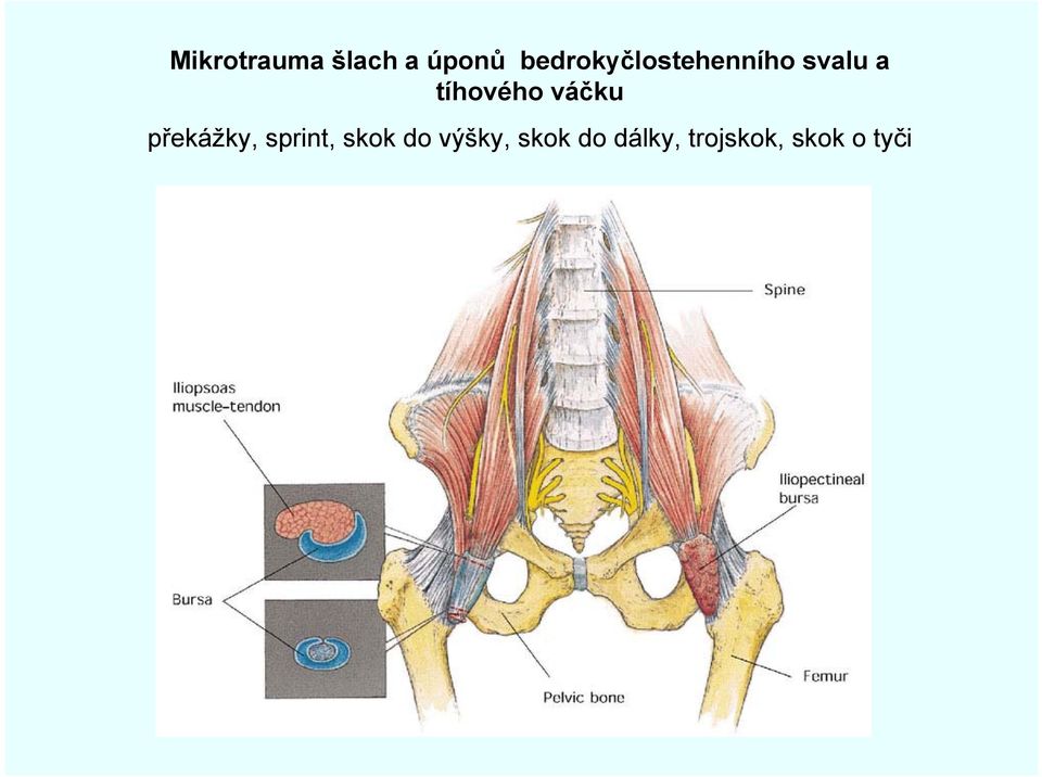 tíhového váčku překážky, sprint,