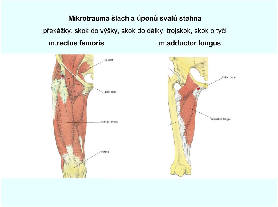 skok do dálky, trojskok, skok o