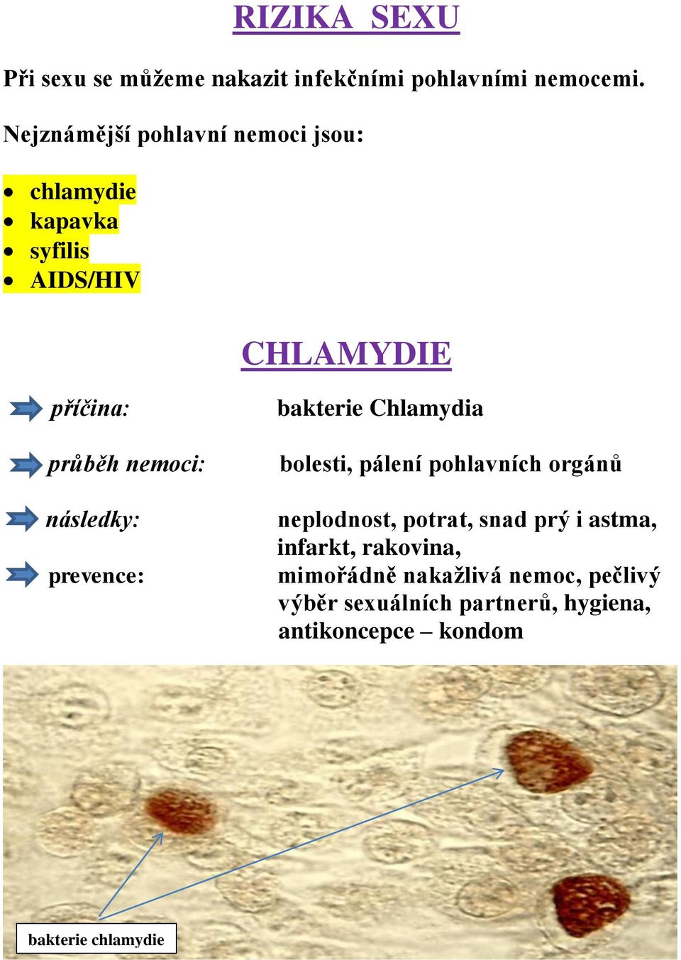 následky: prevence: bakterie Chlamydia bolesti, pálení pohlavních orgánů neplodnost, potrat, snad prý i