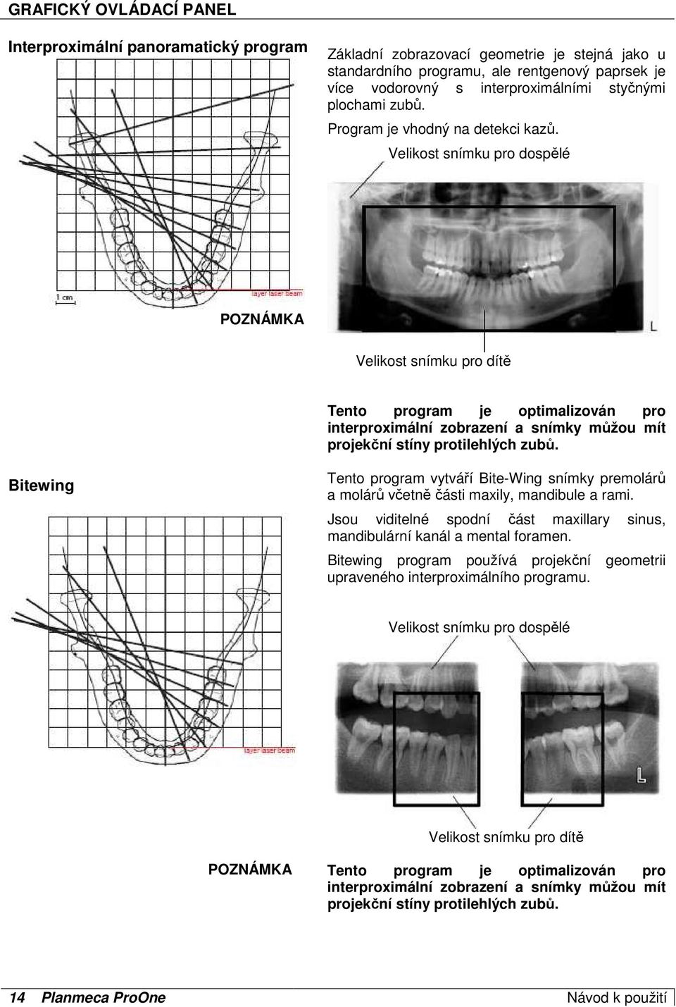 Velikost snímku pro dospělé Velikost snímku pro dítě Tento program je optimalizován pro interproximální zobrazení a snímky můžou mít projekční stíny protilehlých zubů.