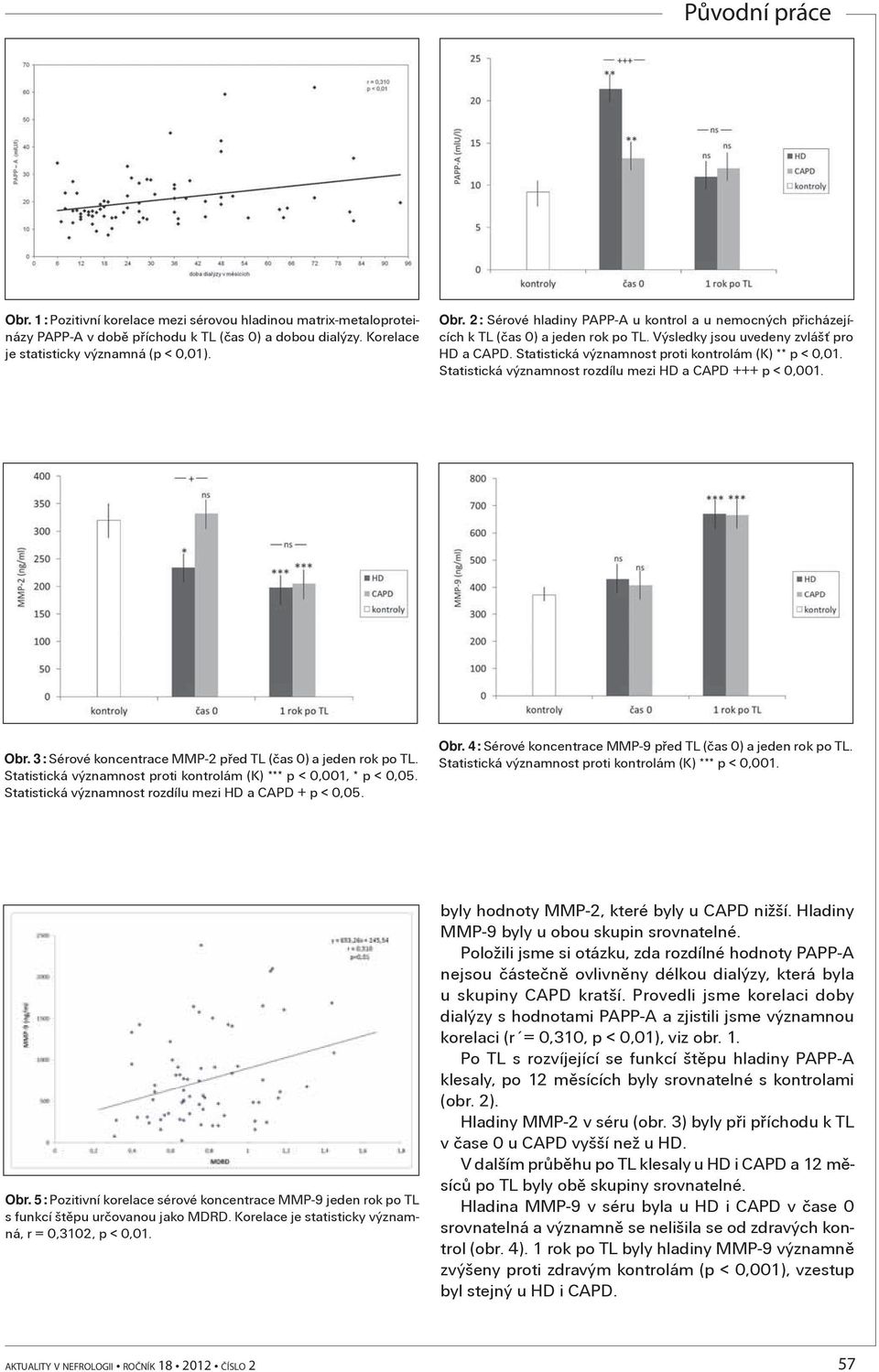 Statistická významnost rozdílu mezi HD a CAPD +++ p < 0,001. Obr. 3: Sérové koncentrace MMP-2 pøed TL (èas 0) a jeden rok po TL. Statistická významnost proti kontrolám (K) *** p < 0,001, * p < 0,05.