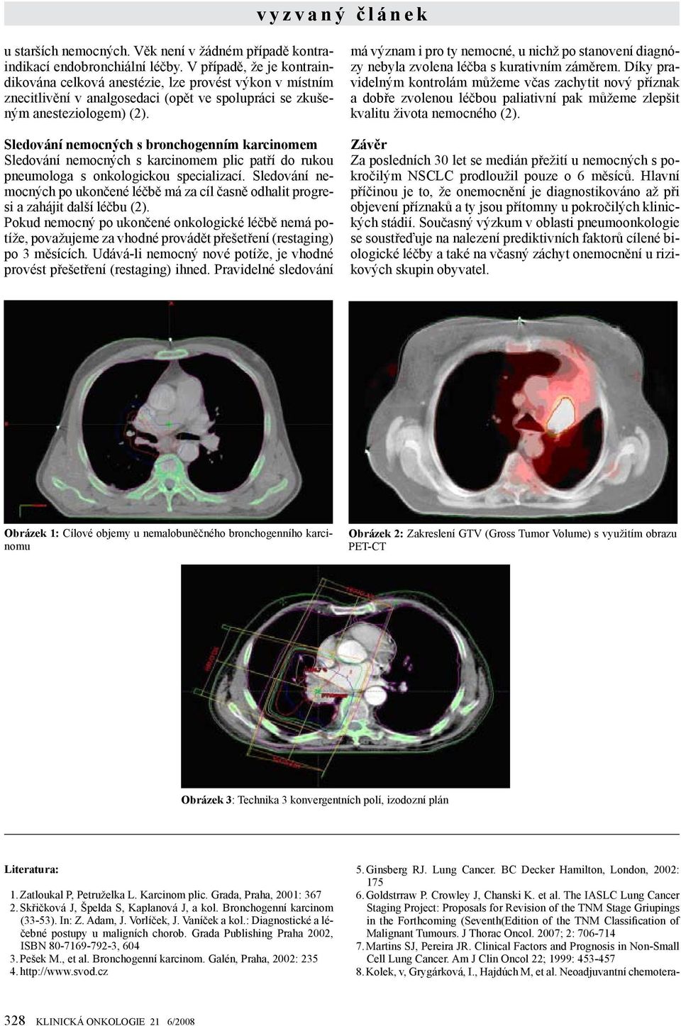 Sledování nemocných s bronchogenním karcinomem Sledování nemocných s karcinomem plic patří do rukou pneumologa s onkologickou specializací.